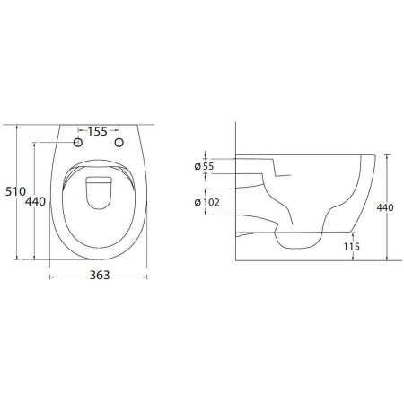 Фото унитаз подвесной безободковый allen brau fantasy 4.11004.sm, розовый